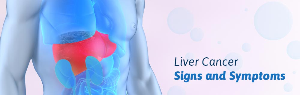 Is liver cancer easy to find in the early stages?