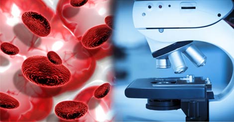 Blood Cancer Diagnosis & Treatment