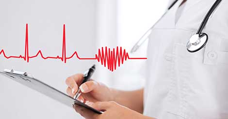 ECG or Electrocardiogram Test