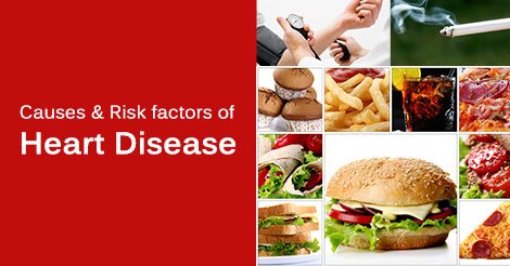 Heart Disease Causes & Risk Factors