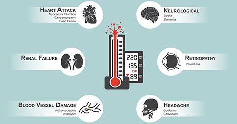 Complications of High Blood Pressure