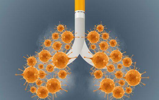 Tobacco Exposure and Covid19 Complications
