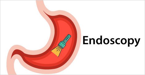 Stomach Cancer - Diagnosis & Treatment