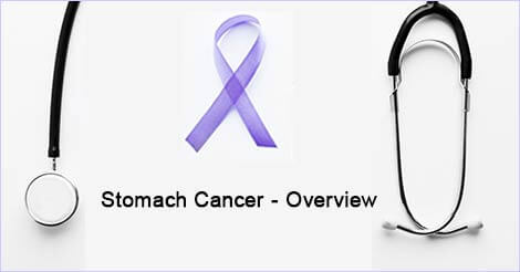 Stomach Cancer - Overview