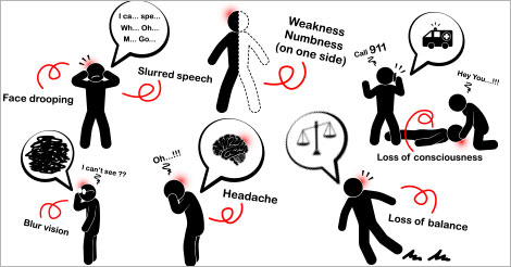 Identify Stroke Symptoms