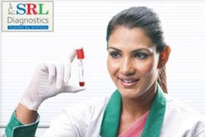 SRL Center