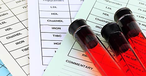 Higher Level of SGPT Risks | Causes | Symptoms | Blood Test