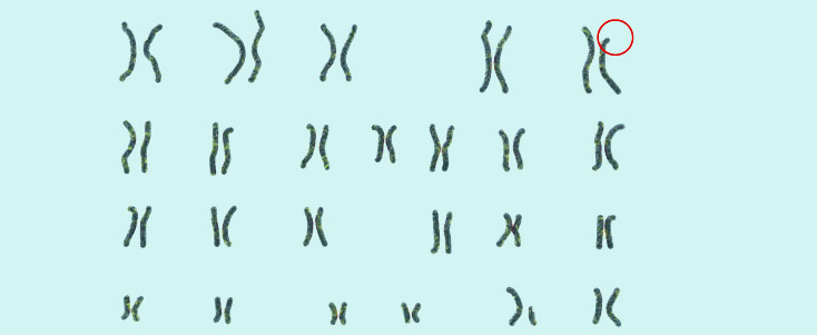 Know Your Chromosomes