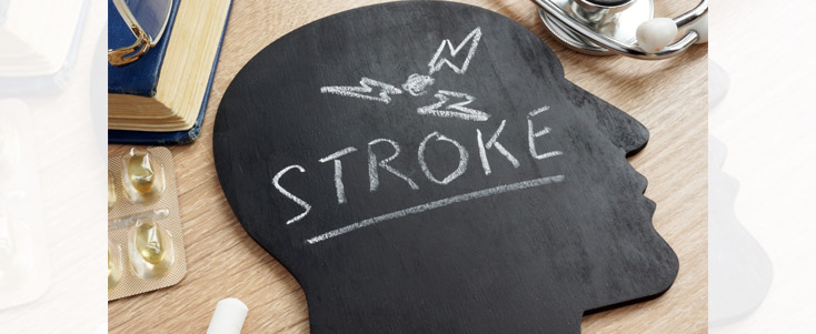 A Family History Increases The Risk of Stroke