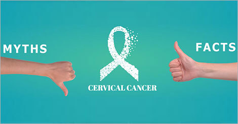 Common Myths and Facts About Cervical Cancer