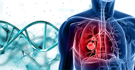 Is COPD Passed On Genetically? Know Your Risk Factors