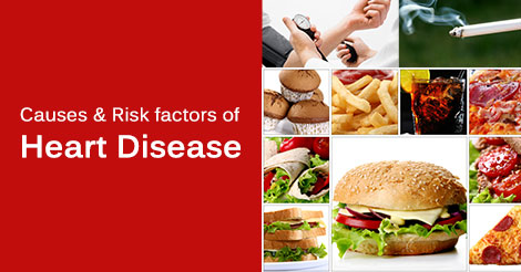 Heart Disease Causes Risk Factors Non Modifiable Modifiable