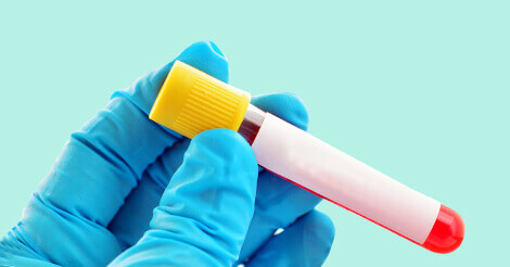 Higher Level Of Sgpt Risks Causes Symptoms Blood Test