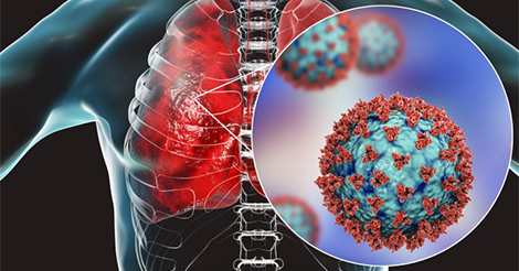 Lung Cancer Prevention through Genetic Testing - Does It Work?