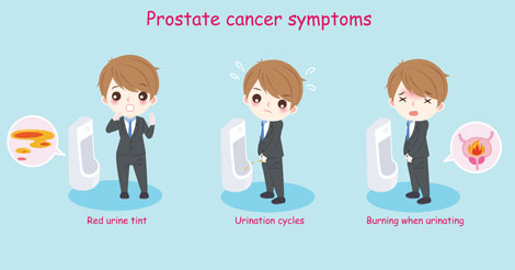 Prostate Cancer - Signs and Symptoms