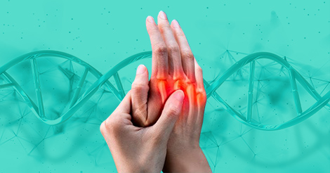 Understanding the Role of Genetics in Rheumatoid Arthritis