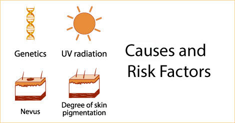 Skin Cancer Causes