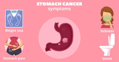 abdominal cancer pain symptom)