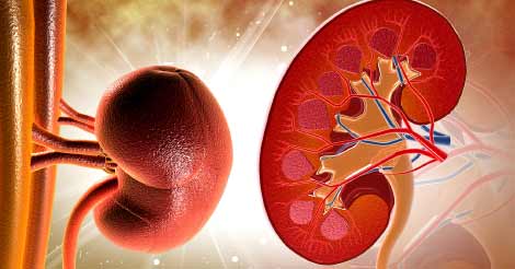 Kidney Diseases