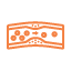 Lipid Profile