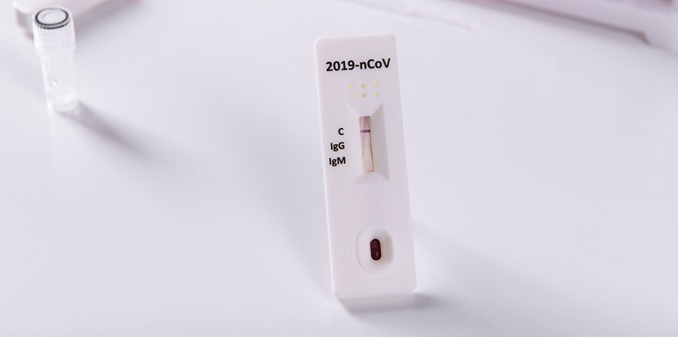 COVID-19 antibody testing