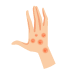 Skin Conditions